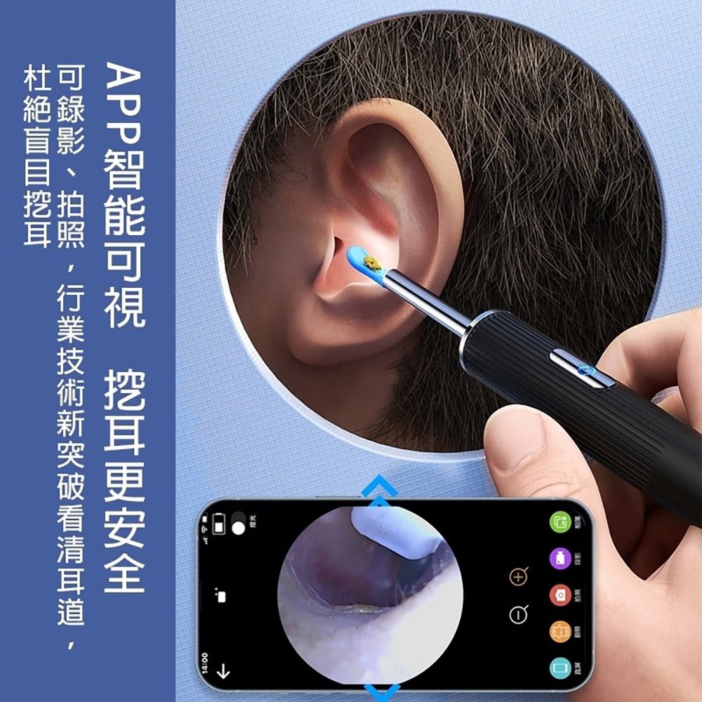 可錄影、拍照,行業技術新突破看清耳道